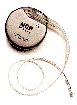 ncpdev1.gif (25680 bytes)